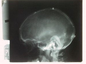 head x-ray 2004